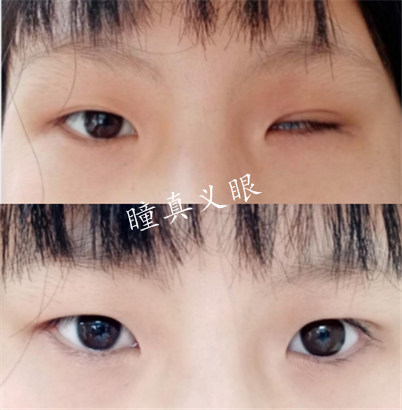 對(duì)比照片