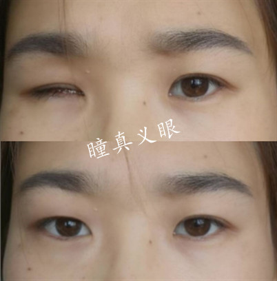 對(duì)比照片