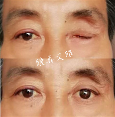 對(duì)比照片