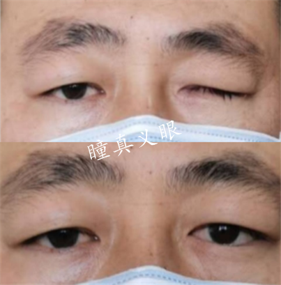 對(duì)比照片