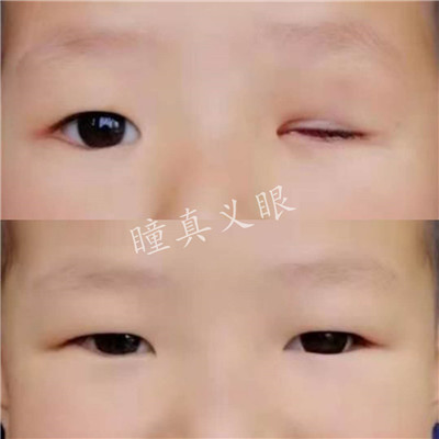 對(duì)比照片