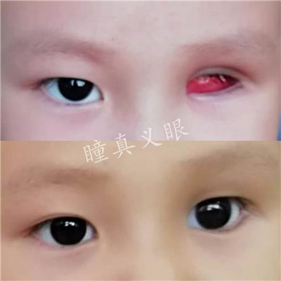 對(duì)比照片